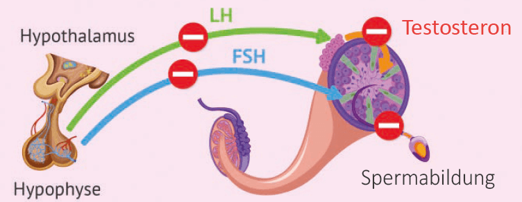 Schema
